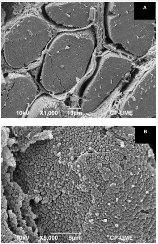 La microscopía electrónica de barrido en las ciencias agrícolas y pecuarias