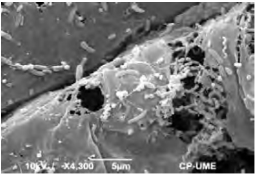 La microscopía electrónica de barrido en las ciencias agrícolas y pecuarias