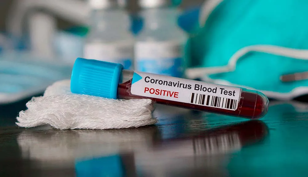 COVID-19, ¿qué es, cómo se propaga y cómo se previene?